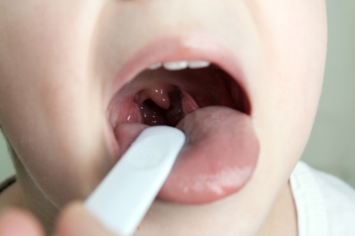Tonsils Removal or Regeneration