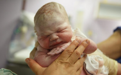 Birth Trauma and Developmental Delays