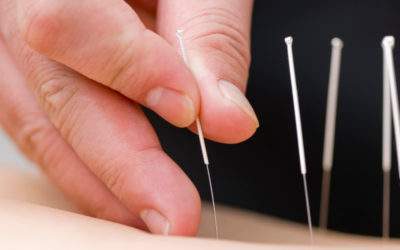Acupuncture for Kids